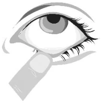 2_Pull down the lower eyelid 