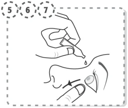 schema_tirer_paupiere_bas_instiller_goutte_unidose_567-V1-20151105