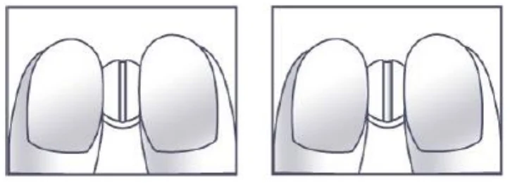 Un dibujo de un ojo
Descripción generada automáticamente con confianza media