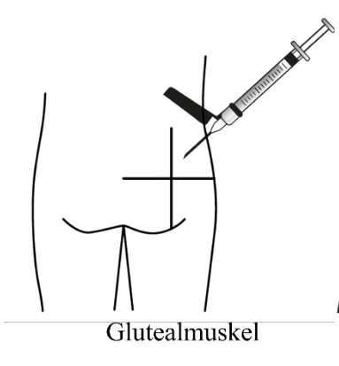 Ein Bild, das Entwurf, Zeichnung, Kunst, Design enthält.

KI-generierte Inhalte können fehlerhaft sein. 