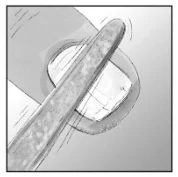 R:\02-Packaging\01-Druckdateien\3_PIL_GI\3-not-yet-on-market\Amorolfin\6-Abbildungen\NP_Zeichnungen_schwarzweiß1-Zuschnitt.jpg