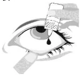 3_Place the tip of the bottle close to but not touching your eye