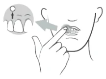 Descriptive graphic for patient information leaflet; described in leaflet text